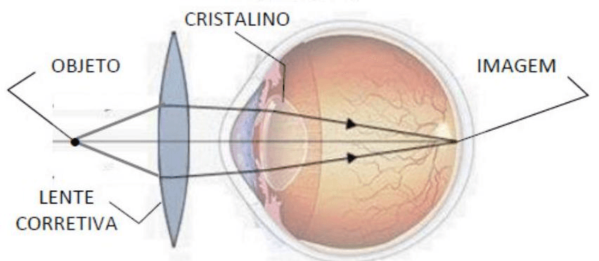 Question illustration
