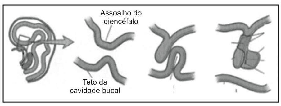 Question illustration